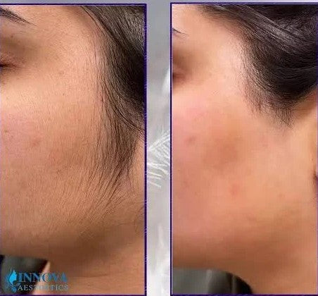 Wiki Special Hair Blocker